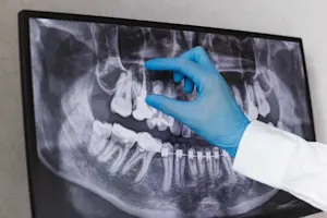 What did the dentist call the x-ray he took of your mouth? image
