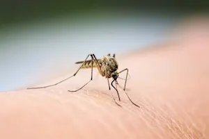 Why did the mosquito go to the dentist? image